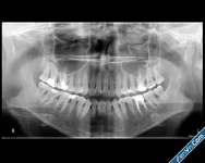 Download DICOM Printer 1